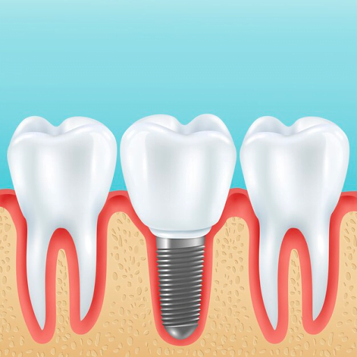 dental issues