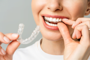 invisalign braces ashburton