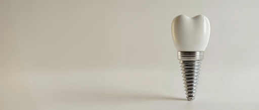 Ashton Avenue Dental Premium Dental Implants services